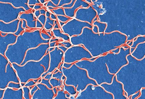 Apr 14, 2020 · lyme disease is caused by a spirochete (bacteria) of the borrelia burgdorferi species. New bacteria species discovered linked to Lyme disease