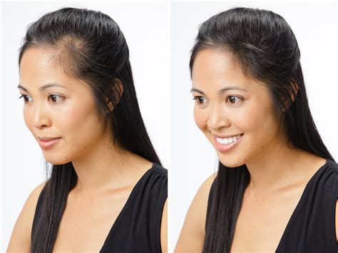 women’s hair loss | WKTV Journal
