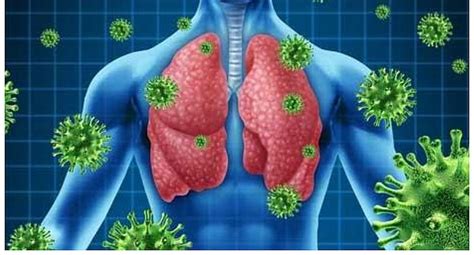 Las Infecciones Respiratorias Agudas Salud Ojo