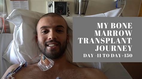 My Bone Marrow Transplant Journey Day 11 To Day 150 Vlog