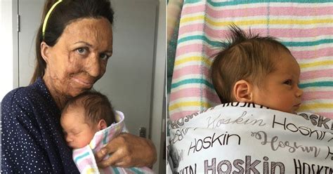 Turia Pitt S Two Parenting Rules Are Absolutely Brilliant Burn Survivor First Baby