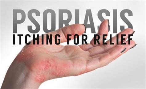Psoriasis Itching For Relief Anti Itchcreams Psoriasis Itch Itch Relief