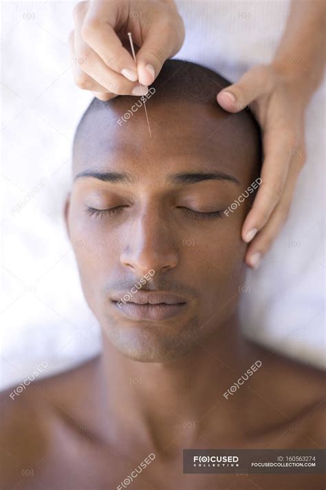 Acupuncturist Inserting Needle Into Male Client Forehead — Chinese Medicine Adults Stock