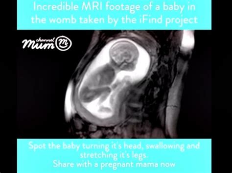 Mri Shows Detailed Images Of 20 Week Unborn Babies Breitbart
