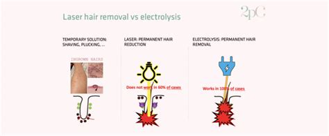 Laser Hair Removal Vs Electrolysis What Is The Difference 2pass Clinic
