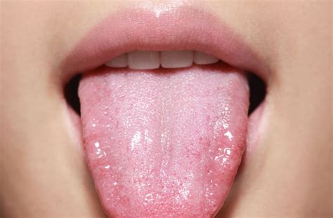 Can Anxiety Affect Your Tongue Etuttor