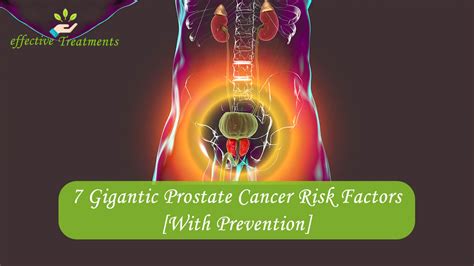 Gigantic Prostate Cancer Risk Factors With Prevention