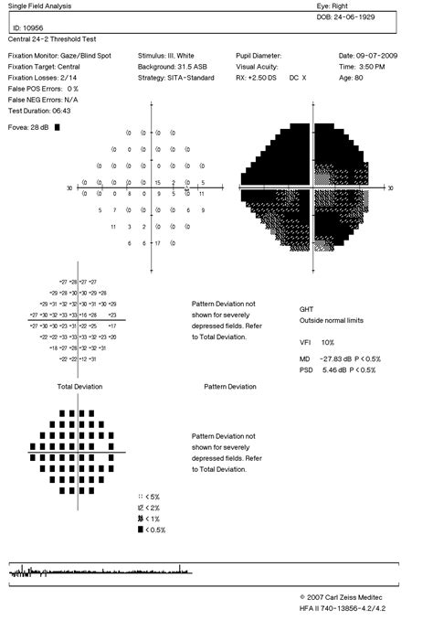 Automated Visual Fields 912 Westmead Eye Manual