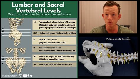 Lumbar And Sacral Spine Landmarks Youtube