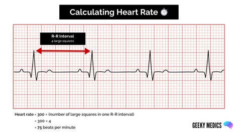 Ekg Heart Rate Calculator
