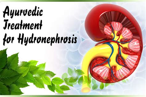 Ayurvedic Treatment For Kidney Hydronephrosis