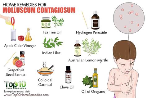 Molluscum contagiosum is a common skin infection caused by a virus. Home Remedies for Molluscum Contagiosum | Top 10 Home Remedies