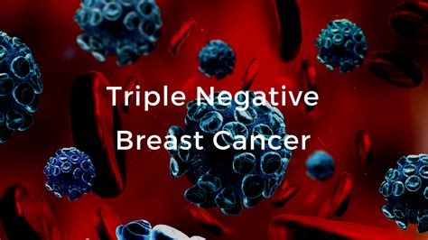 Triple Negative Breast Cancer The Breast Cancer School For Patients