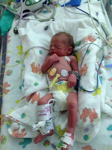33 Week Preemie Preemie Babies Premature Baby Baby Boy Newborn