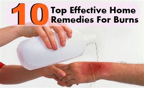 Home Remedies For Burn Ways To Treat A Burn At Home Home Remedies