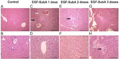 EGF SubA Causes Pathological Changes In Murine Livers Hematoxylin And Download Scientific