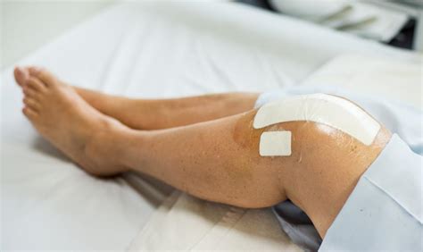 Acl Reconstruction Heres What To Expect On The Road To Recovery