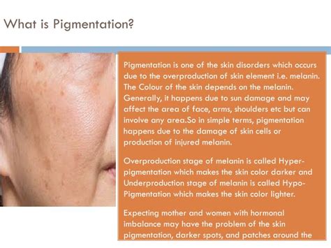 Ppt Best Doctor For Pigmentation In Gurgaon Powerpoint Presentation