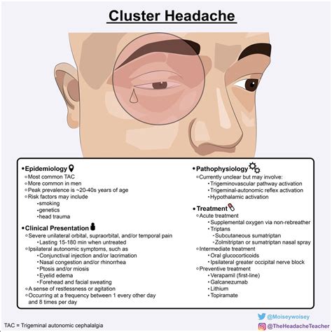 1 Cluster Headache Is The Most Common Trigeminal Autonomic Cephalalgia