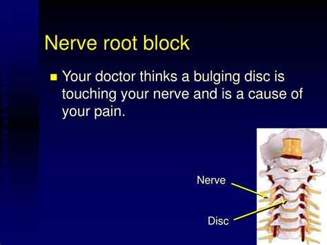 Ppt Cervical Nerve Root Block Powerpoint Presentation Free Download