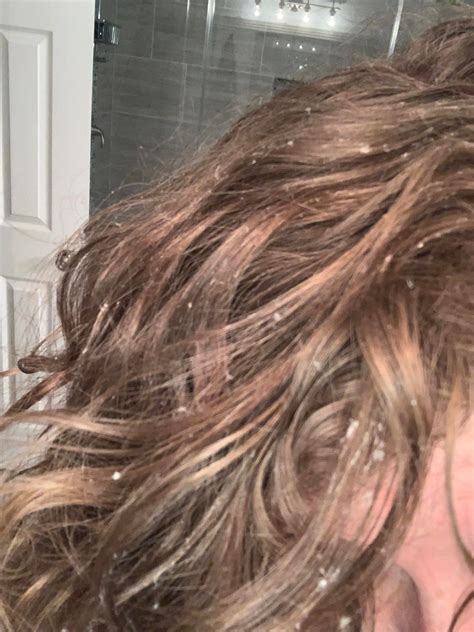 Help Dandruff Or Too Much Product More Info And Routine In Comments