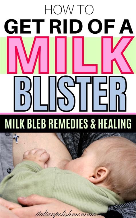 Breastfeeding Blister Treatment Breastfeeding Essentials