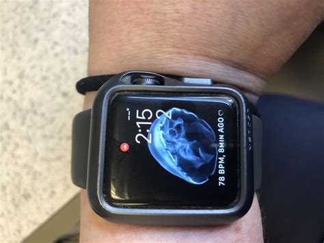 Apple Watch Series 4 Red Dot - Apple Community