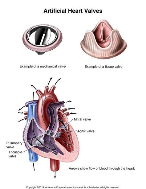 Artificial Heart Valve