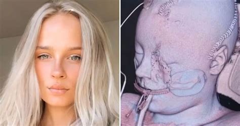 Angel Lynns Skull Scans Show Horror Injuries When She Fell From Van At