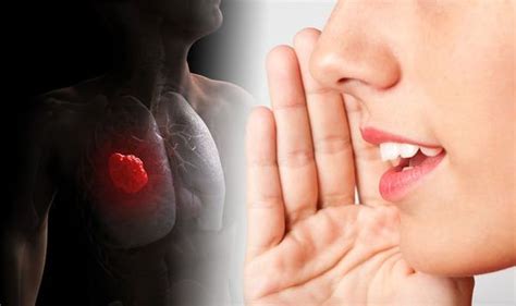 Stop dog coughing fast with natural otc cough syrup. Lung cancer symptoms: Does your voice sound like this ...