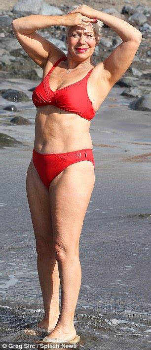 Denise Welch In Bikini After Recent Controversy Over Unhealthy Weight