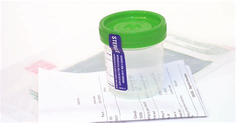What You Need To Know About Dot Drug Testing