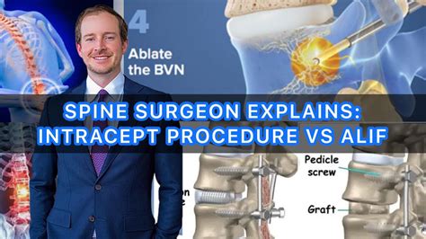 Spine Surgeon Explains Intracept Procedure Vs Alif Surgery Youtube