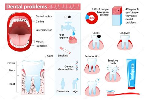 Dental Problems Infographic — Stock Vector © Edesignua 93653868