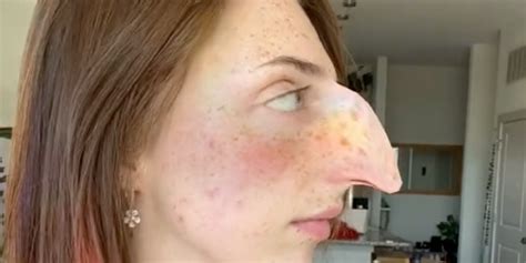 Woman Goes Viral For Blasting Offensive Hooked Nose Tiktok Trend