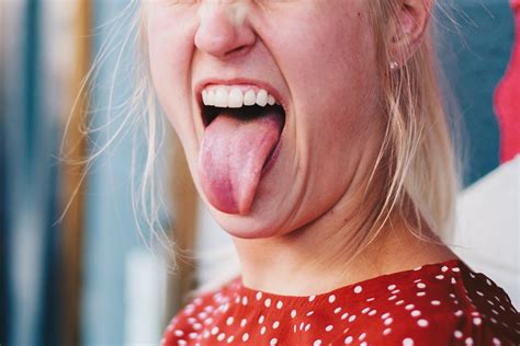 Oral Ulcers Mouth Sores Battling Lupus Symptoms Lupuscorner