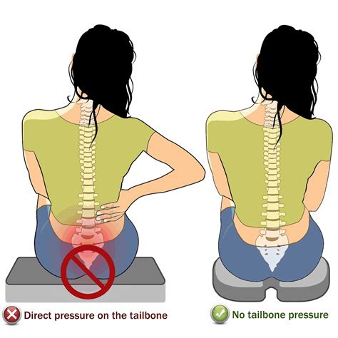 Tailbone Pain Causes And Treatment For Coccyx