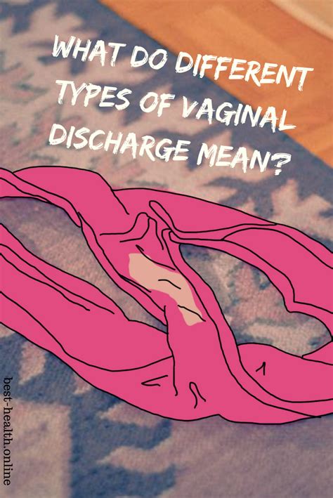Carry1 All About Health What Do Different Types Of Vaginal Discharge Mean