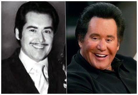 Wayne Newton plastic surgery before and after photos ...