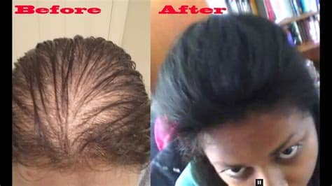 When we say best hairstyles for asian men, what we really mean is the best hairstyles from short cuts to short sides, long top haircuts, these are 29 of the best hairstyles for asian men. how to make thin hair look thicker using hair pieces - YouTube