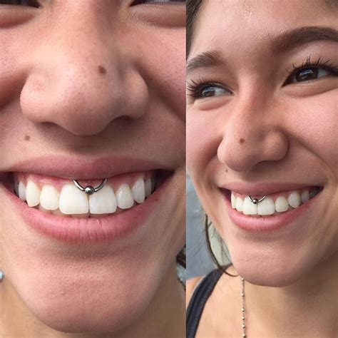 50 Impressive Smiley Piercing Ideas A Trendy Piercing To Complement