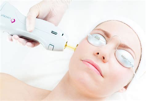 Laser Pigmentation Removal Skin Smart Clinic