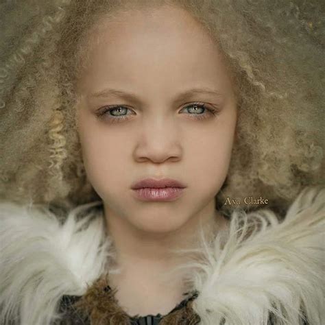 Meet Ava Clark The Beautiful And Little Albino Black Girl Albinism