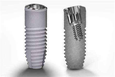 Deep Conical Dc Dental Implants Southern Implants