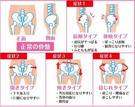 【骨盤矯正】つらい生理痛や便秘、更年期による身体の不調を解消しませんか。