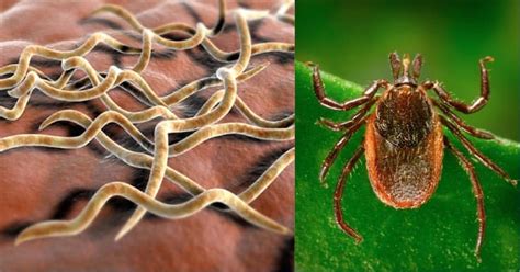 How To Recognize An Infected Tick Bite And What You Can Do Immediately