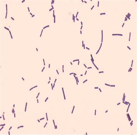 Bacillus Cereus Simple Stain