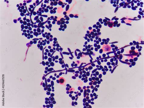 Branching Budding Yeast Cells With Pseudohyphae In Gram Stain F Stock