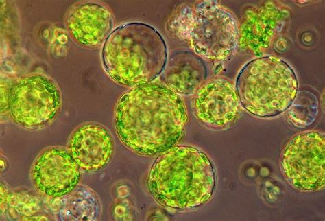 There are three distinct layers in the electron microscope revealed that the cell wall is composed of two main parts such as microfibrils and matrix. What is protoplast? - Quora