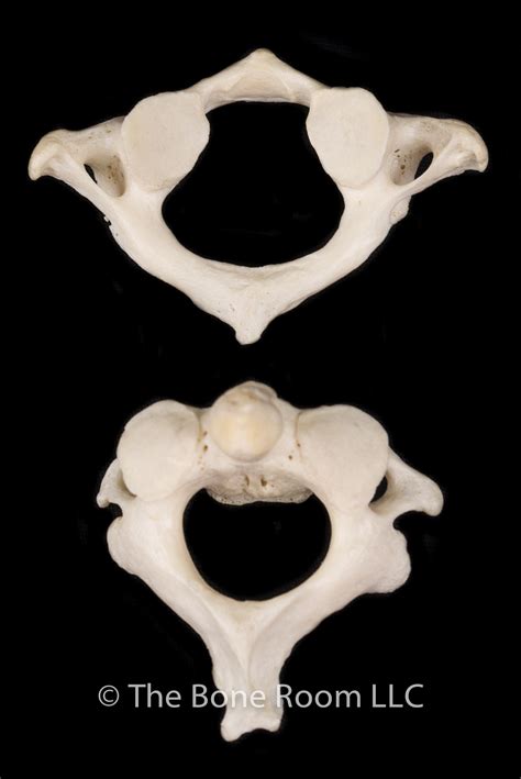 What is axis vs atlas? Human Atlas & Axis Vertebrae Set